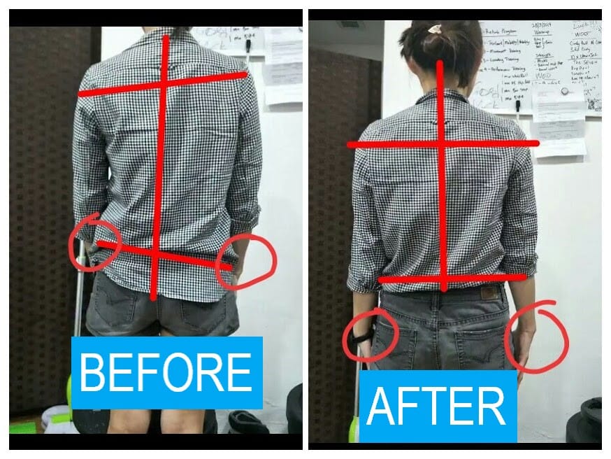 Shoulder pain due to bad posture